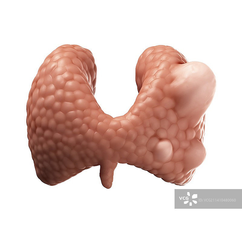 甲状腺癌艺术插图图片素材
