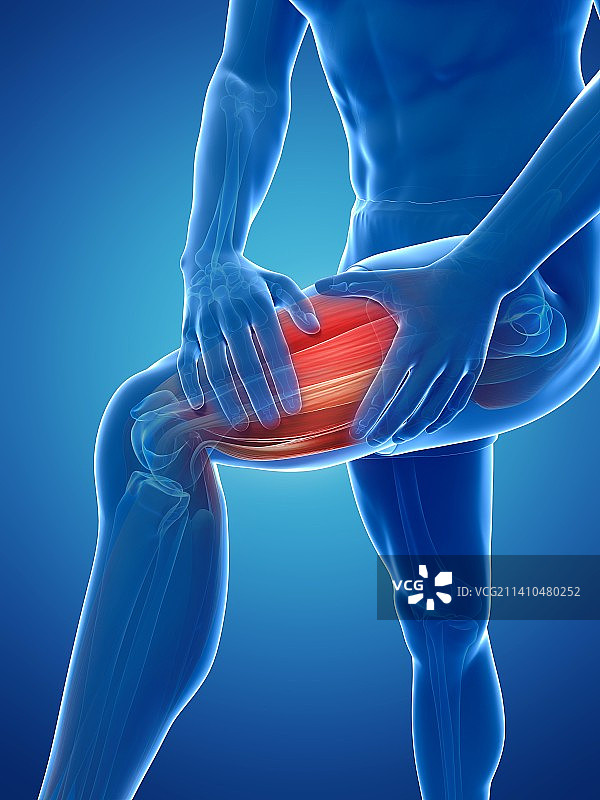 腿抽筋，艺术作品图片素材