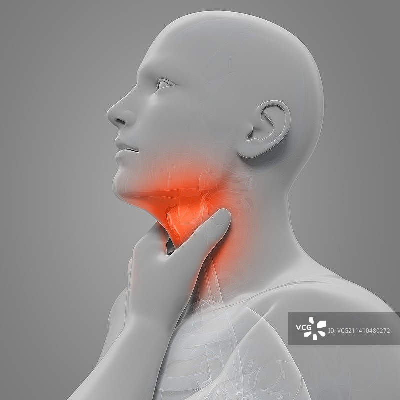 嗓子疼，艺术作品图片素材