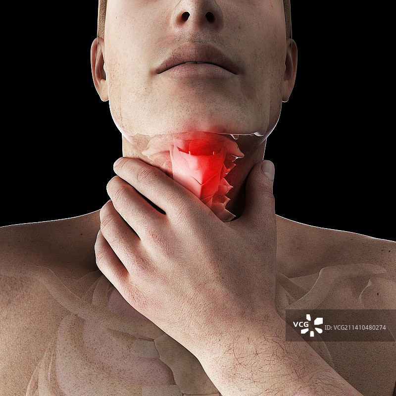 嗓子疼，艺术作品图片素材