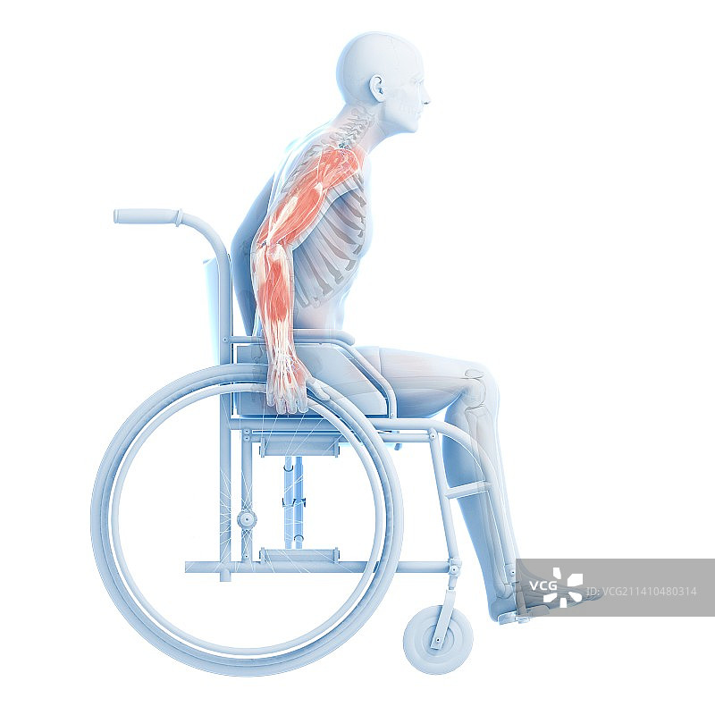 轮椅上的男人，艺术作品图片素材