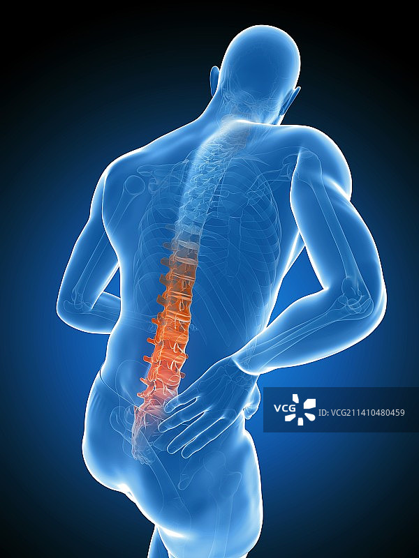 背痛艺术作品图片素材