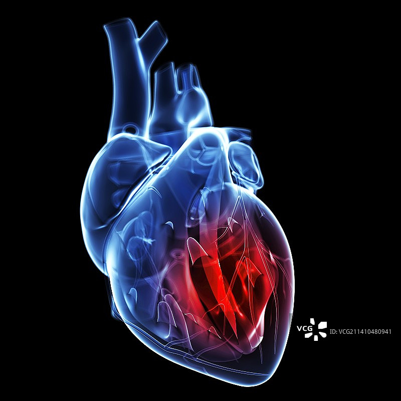 心脏病发作艺术图图片素材
