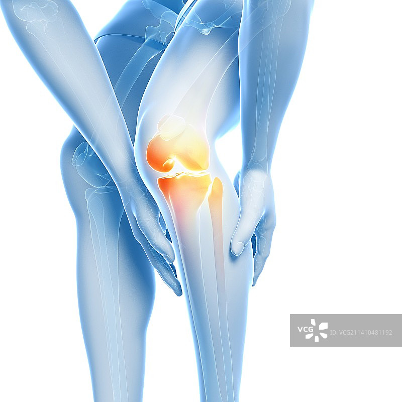 疼痛的膝盖，图示图片素材