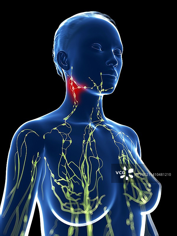 发炎的淋巴结，艺术作品图片素材