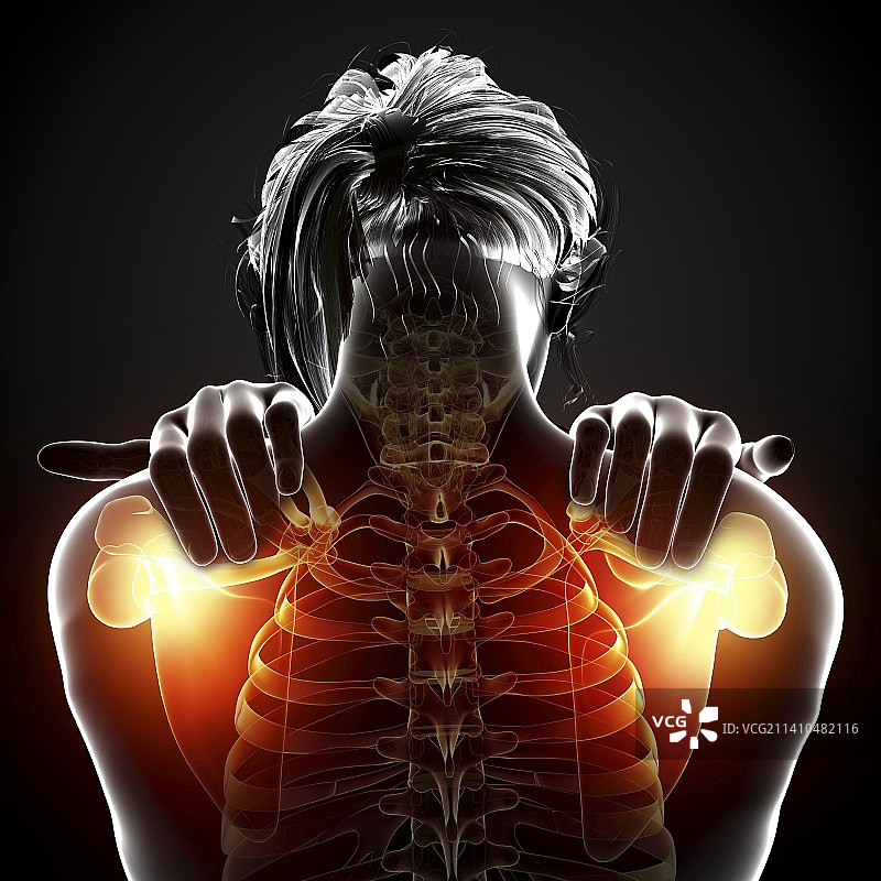 肩部疼痛，艺术作品图片素材