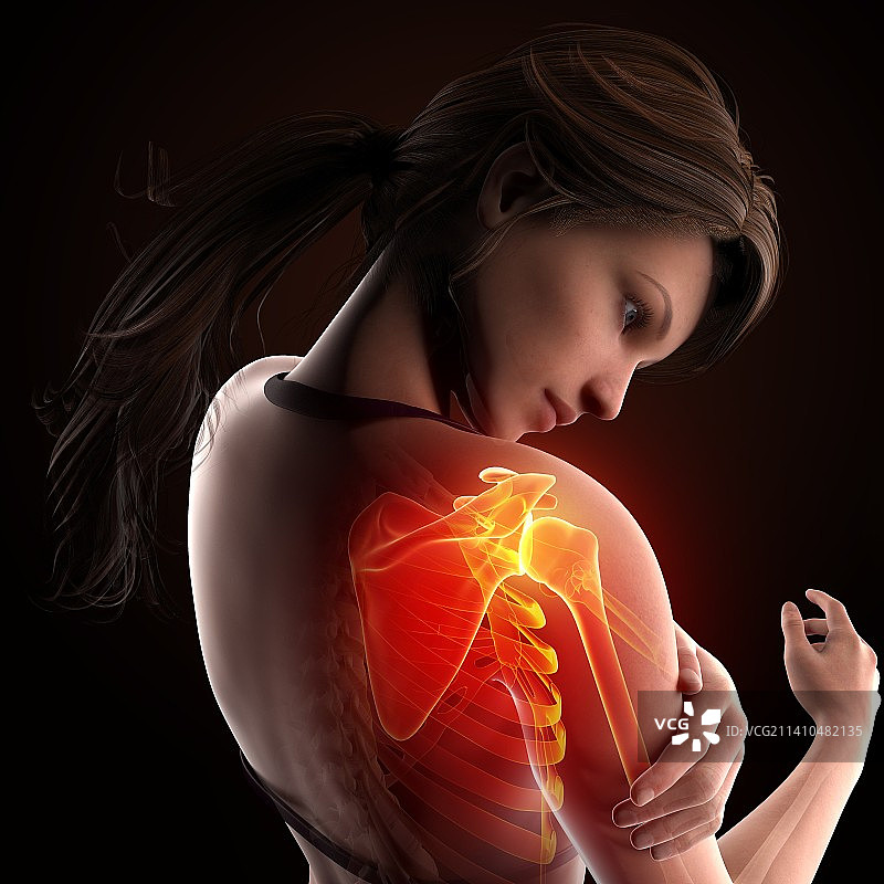 肩部疼痛，艺术作品图片素材