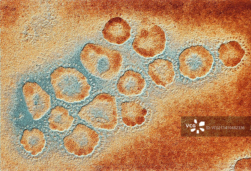 冠状病毒簇的透射电镜图片素材