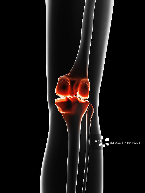 人体膝关节艺术图图片素材