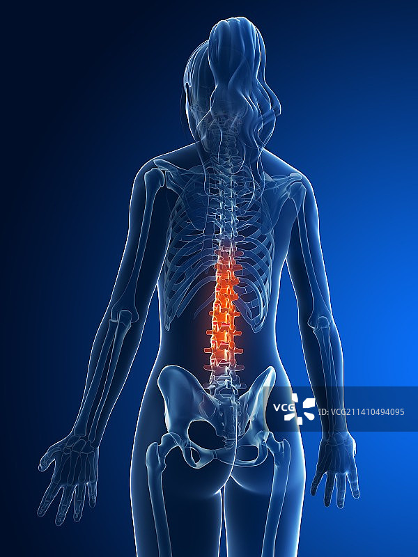 女性腰椎图片素材