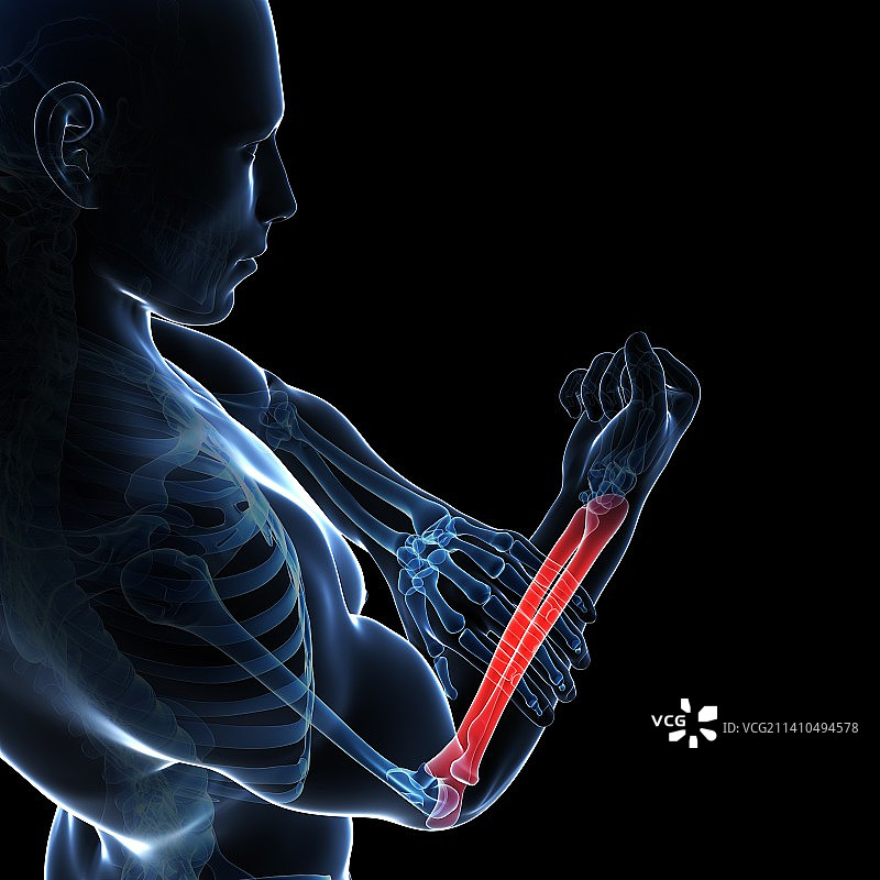 人类手臂疼痛艺术作品图片素材