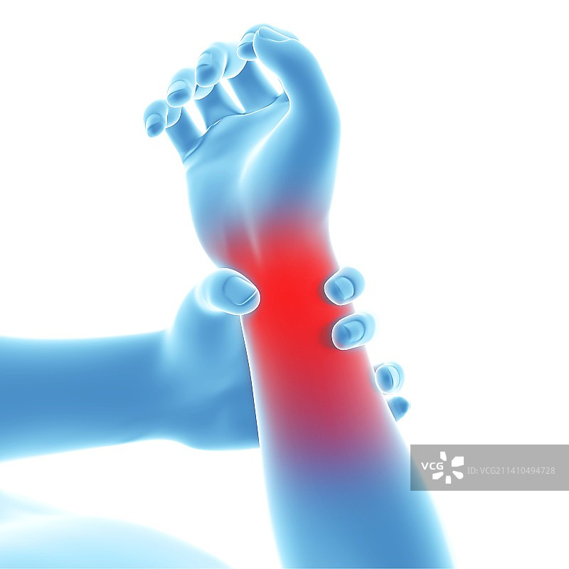 人类手腕疼痛，艺术作品图片素材