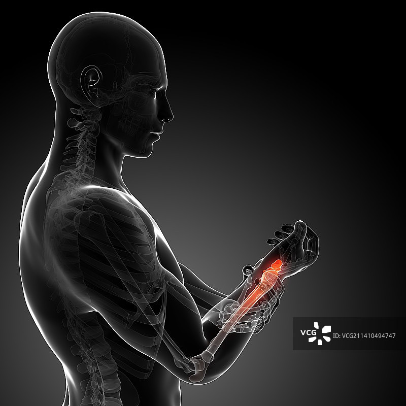 人类手腕疼痛，艺术作品图片素材