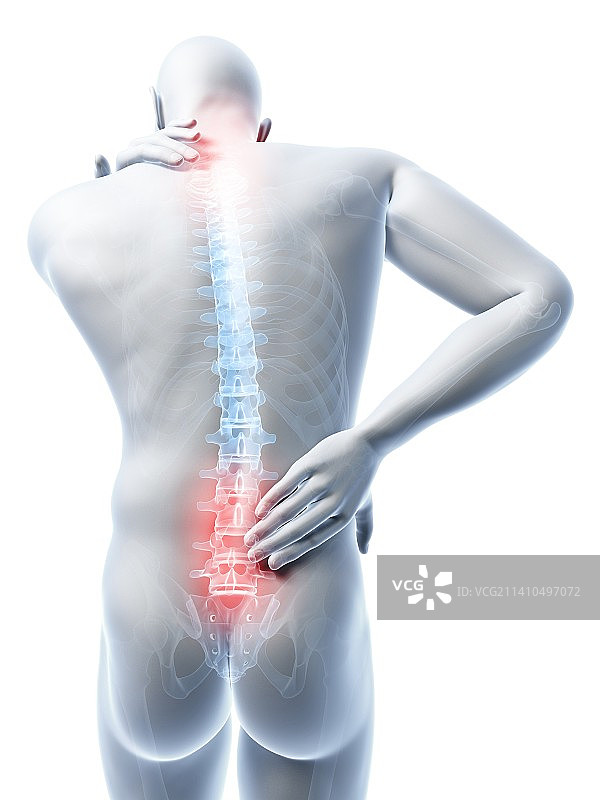 人类背痛医学插画图片素材