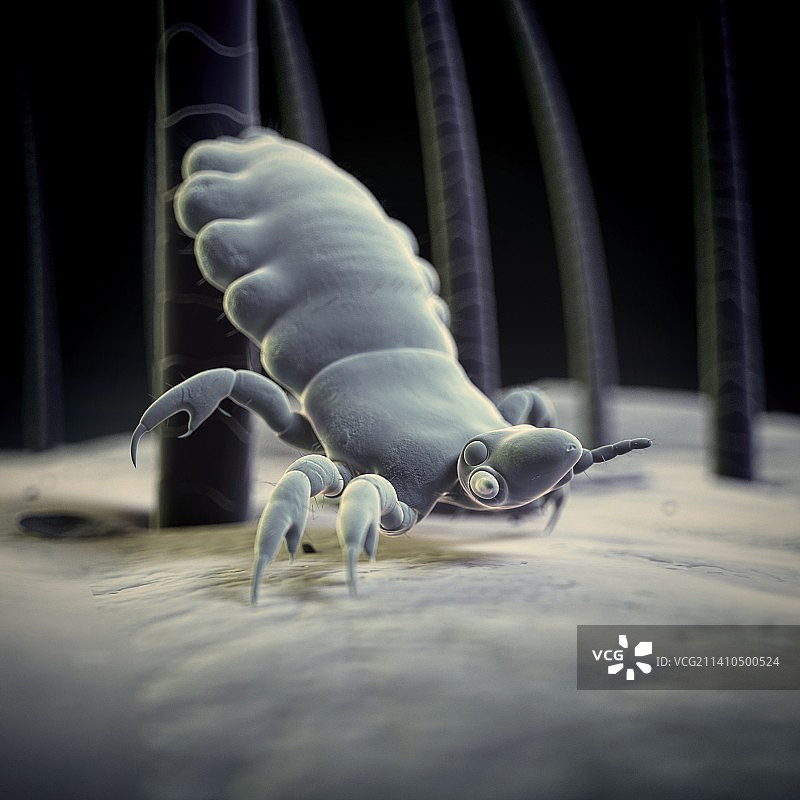 头虱插画图片素材