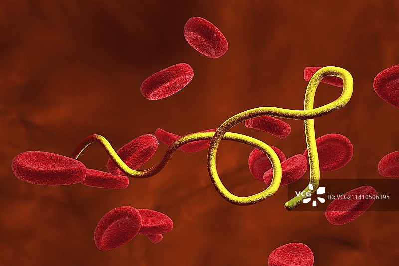 血液中的伯氏疏螺旋体细菌图片素材