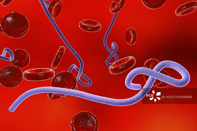 埃博拉病毒示意图图片素材