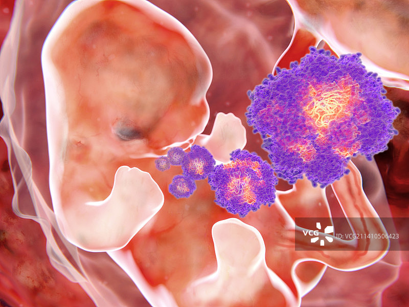 胎儿与寨卡病毒，图示图片素材