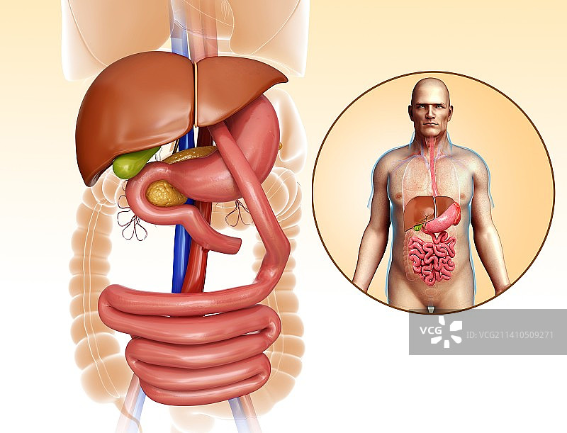胃旁路手术示意图图片素材