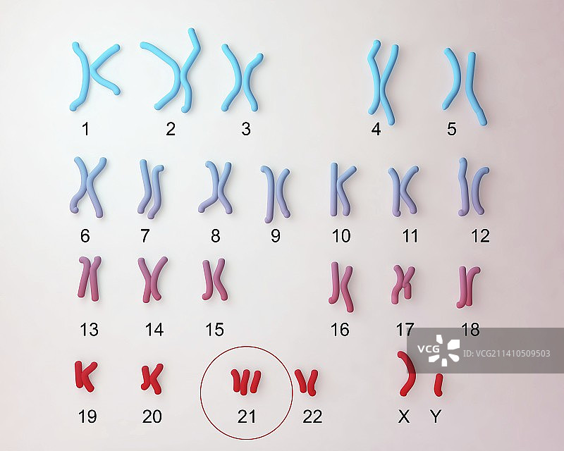 唐氏综合征核型图图片素材