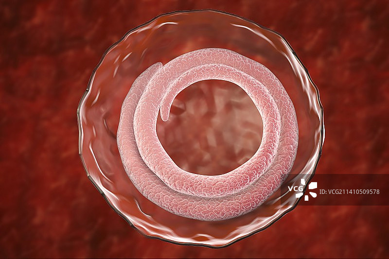 旋毛虫蛔虫，图示图片素材