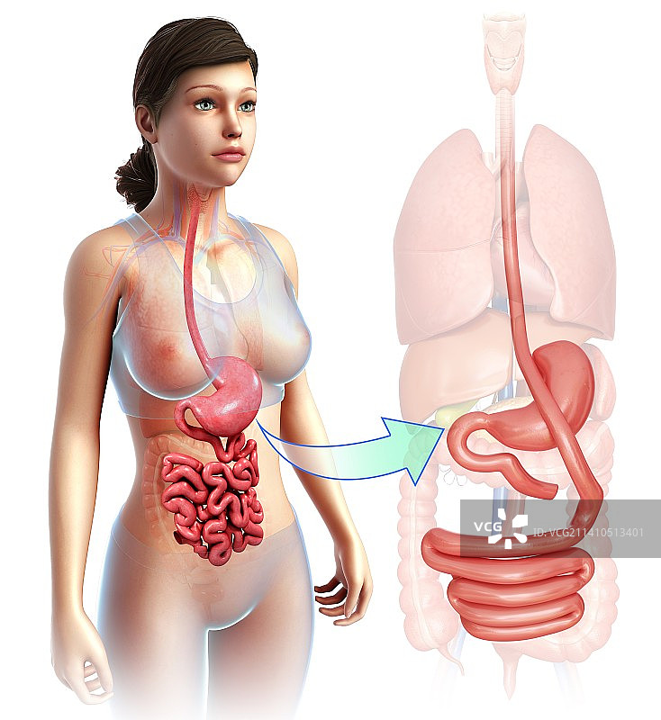 胃旁路手术示意图图片素材