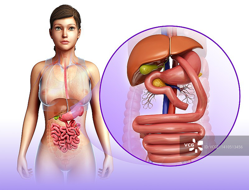 胃旁路手术示意图图片素材