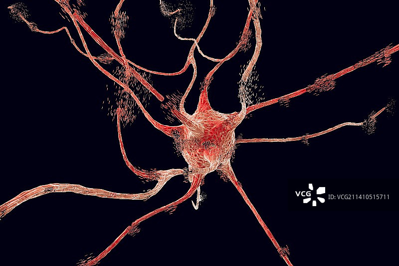 神经元凋亡，图示图片素材