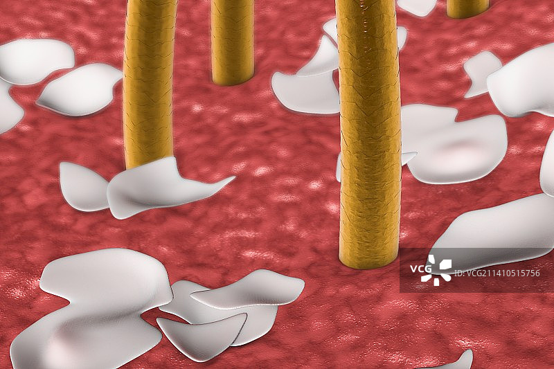 带头皮屑的人类皮肤插图图片素材