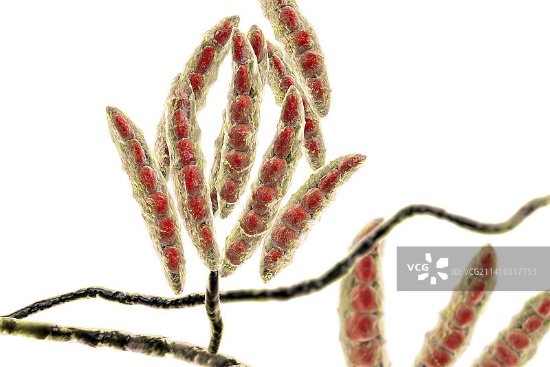 镰刀菌真菌分生孢子，图示图片素材