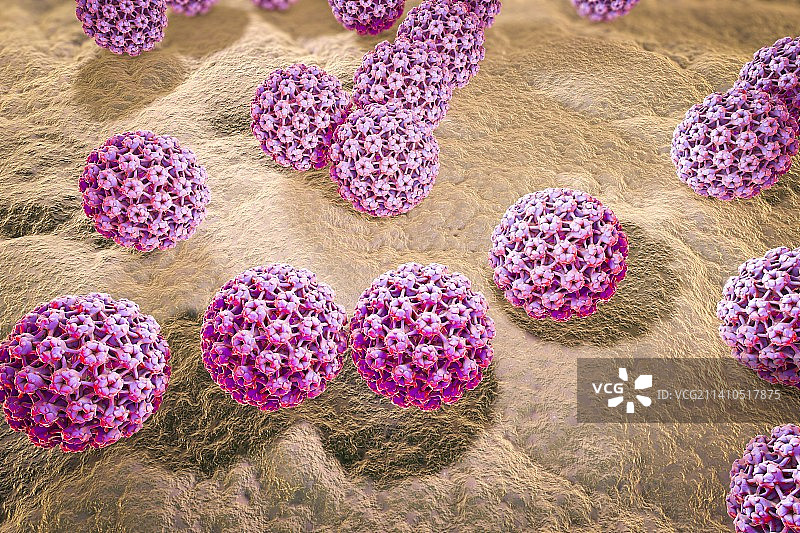 人乳头瘤病毒，图示图片素材