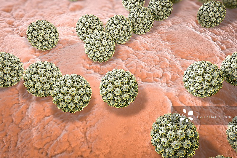 人乳头瘤病毒，图示图片素材