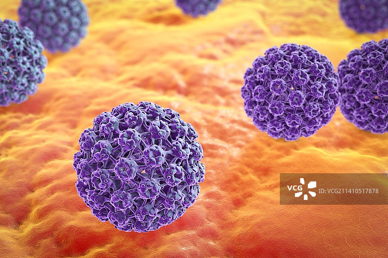 人乳头瘤病毒，图示图片素材