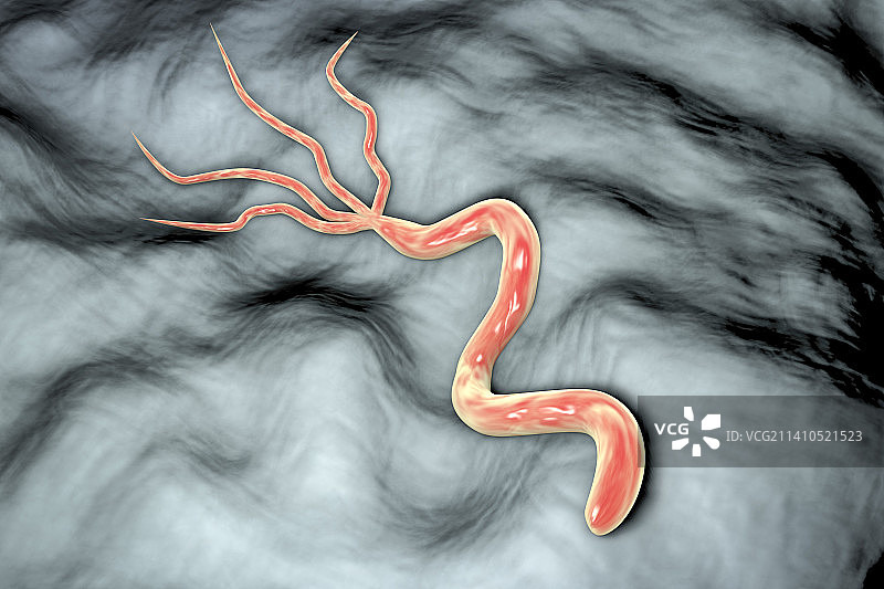 幽门螺杆菌图片素材