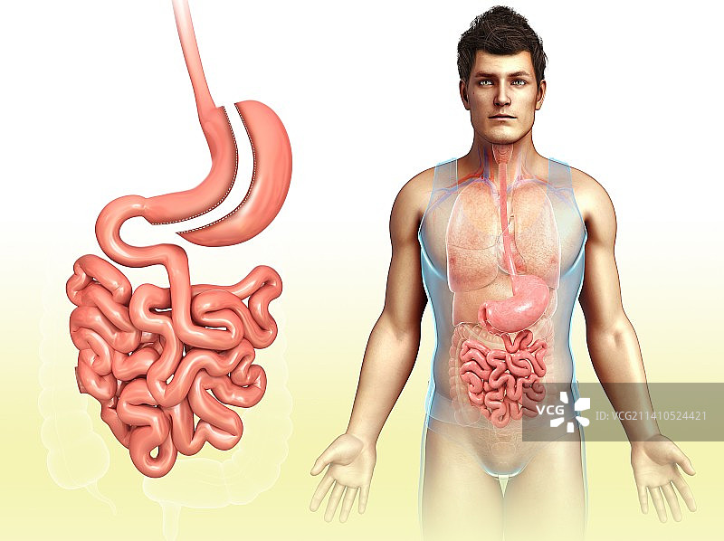 袖状胃切除术插图图片素材