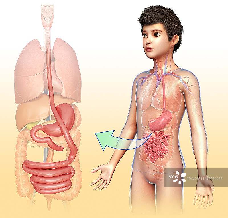 胃旁路手术示意图图片素材
