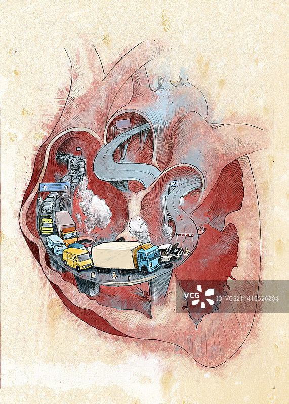 堵塞的心脏概念图图片素材