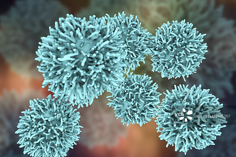 甲状腺癌细胞，图示图片素材