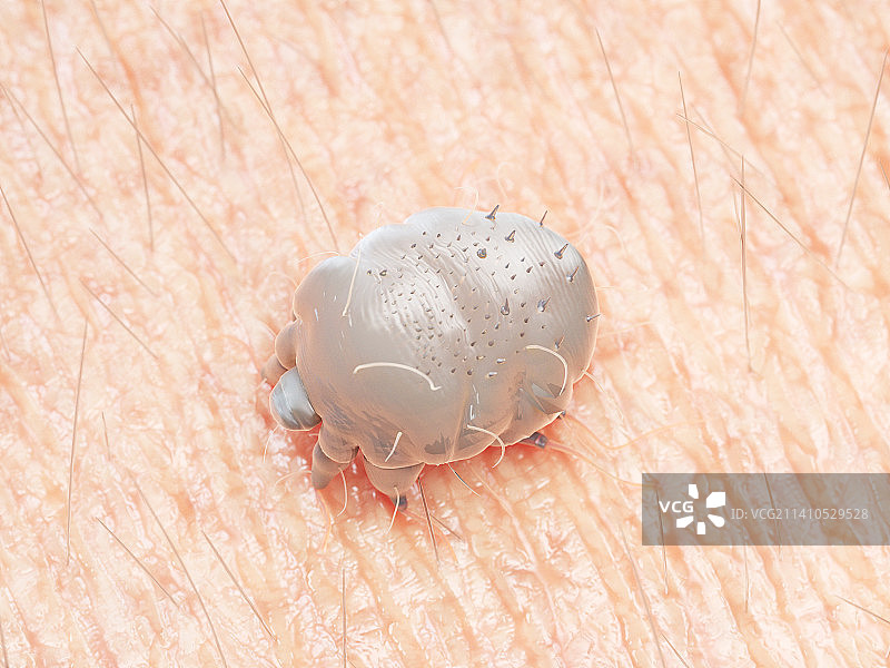 疥螨插画图片素材