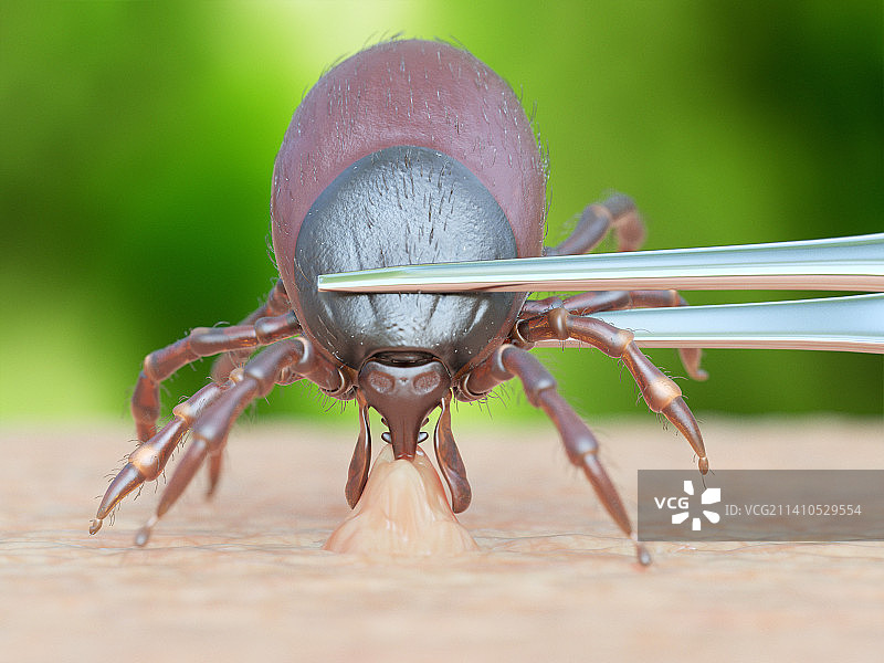 蜱虫移除插画图片素材