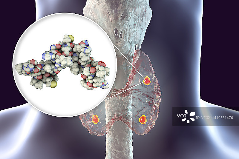 甲状旁腺和甲状旁腺激素，图示图片素材