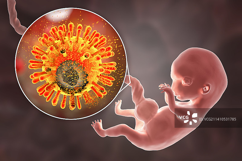 阻止HIV经胎盘传播示意图图片素材