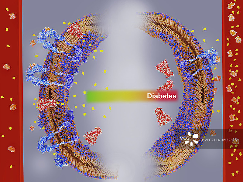 胰岛素抵抗与糖尿病插图图片素材