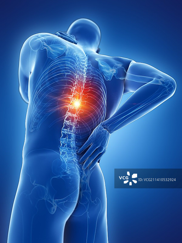 背痛，概念插图图片素材