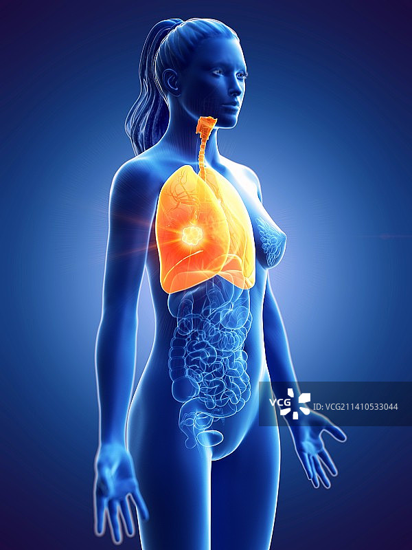 肺癌概念图图片素材