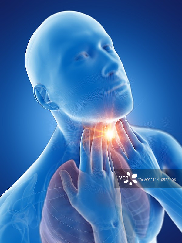 嗓子疼概念图图片素材