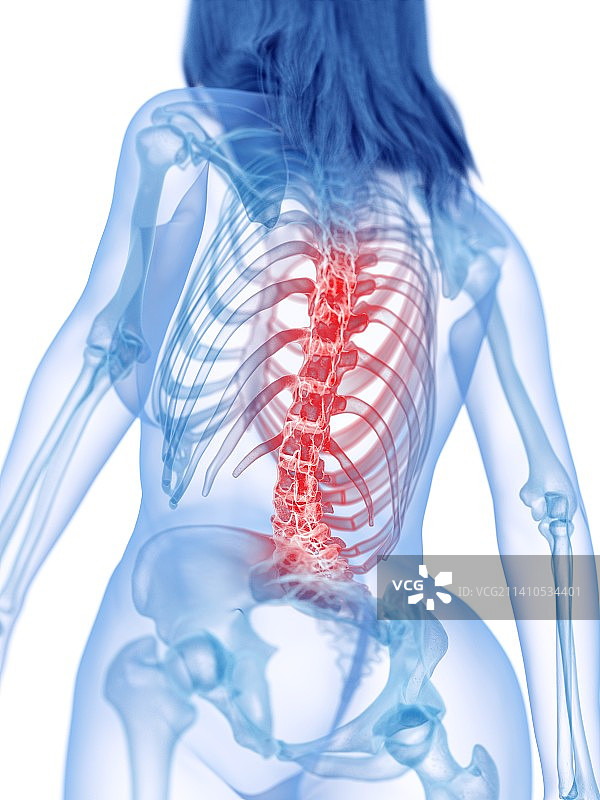 背痛，概念插图图片素材