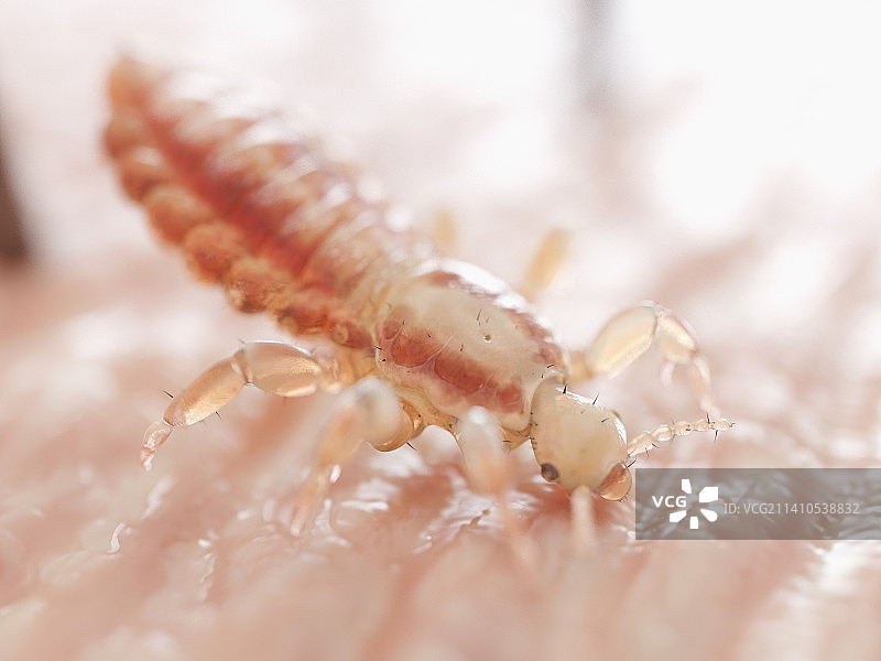 头虱插画图片素材