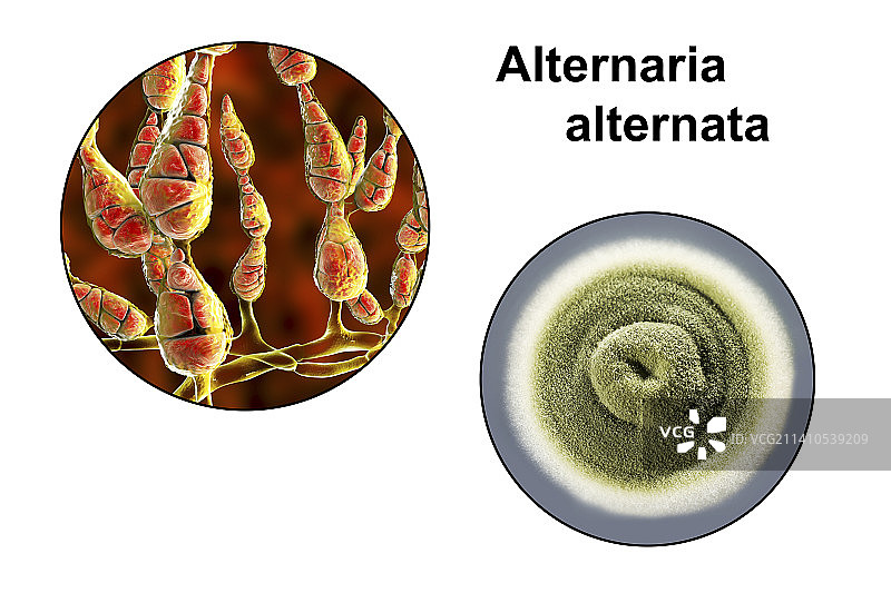 链格孢菌组合图像图片素材