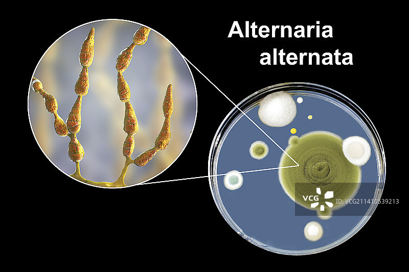 链格孢菌组合图像图片素材